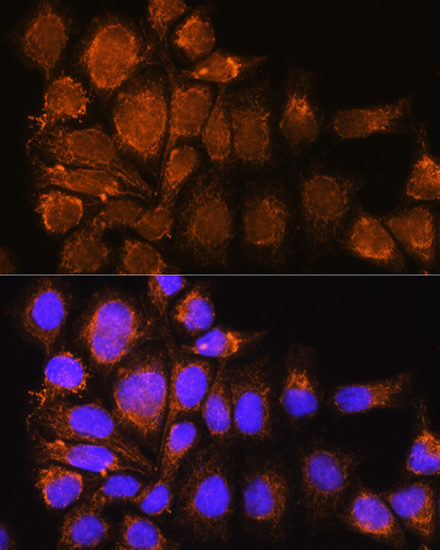 SYNE3 Polyclonal Antibody