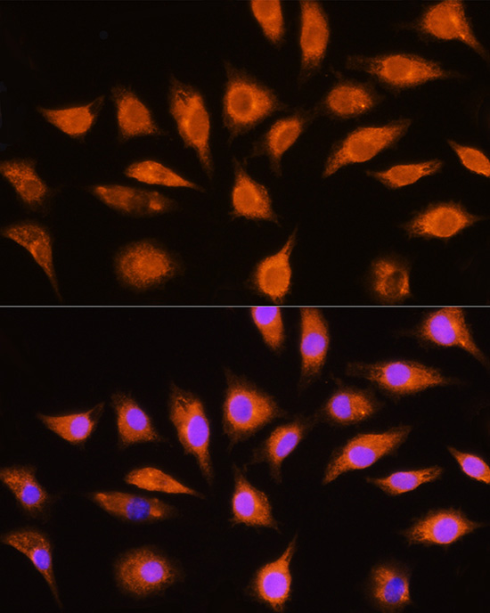 [KO Validated] GNAI3 Polyclonal Antibody