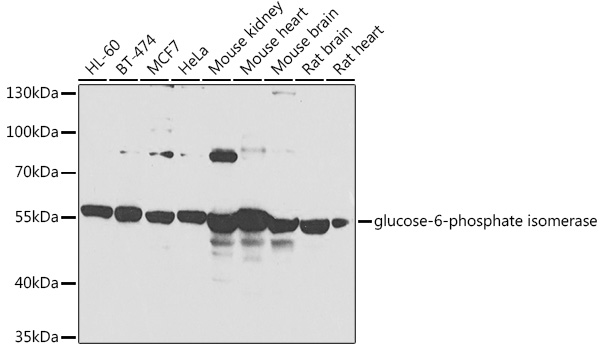 GPI Polyclonal Antibody