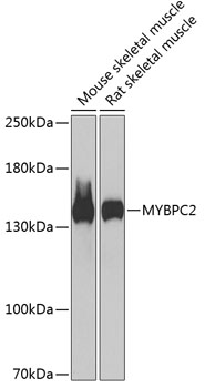 MYBPC2 Polyclonal Antibody