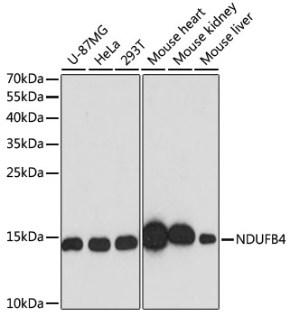 [KO Validated] NDUFB4 Polyclonal Antibody