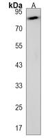 CDHR5 Polyclonal Antibody