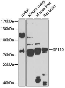 SP110 Polyclonal Antibody