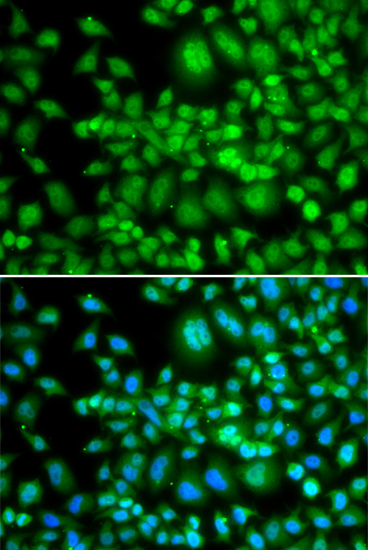 SETD5 Polyclonal Antibody