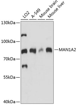 MAN1A2 Polyclonal Antibody