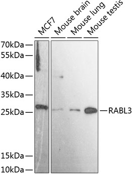 RABL3 Polyclonal Antibody