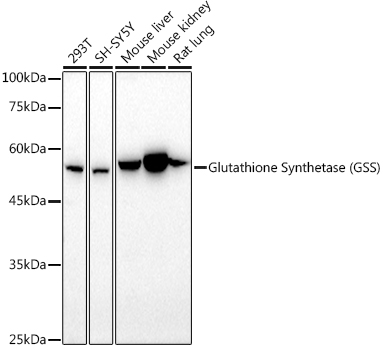 [KO Validated] GSS Polyclonal Antibody
