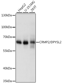 [KO Validated] DPYSL2 Polyclonal Antibody