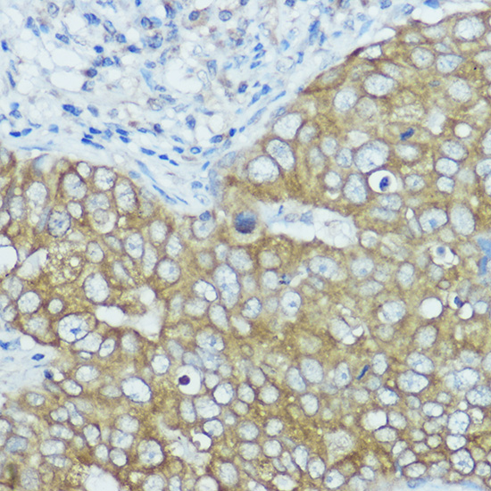 BSCL2 Polyclonal Antibody