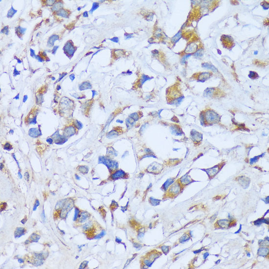 ACADSB Polyclonal Antibody
