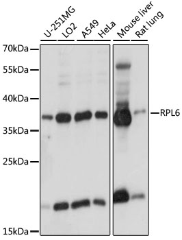 RPL6 Polyclonal Antibody