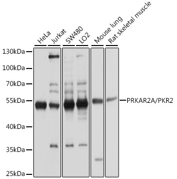 [KO Validated] PRKAR2A Polyclonal Antibody