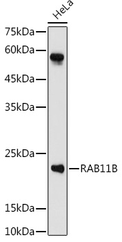 RAB11B Polyclonal Antibody