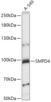 SMPD4 Polyclonal Antibody