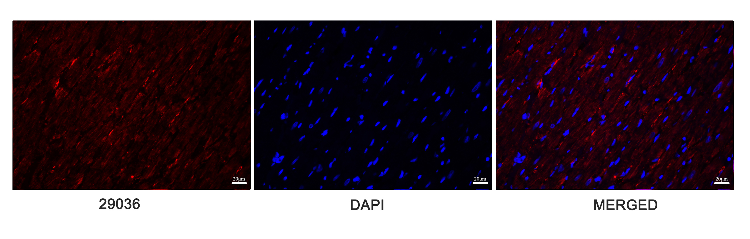 FoxO3a Polyclonal Antibody
