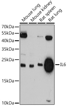 IL6 Polyclonal Antibody