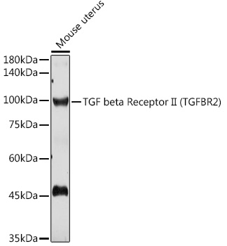 TGFBR2 Polyclonal Antibody