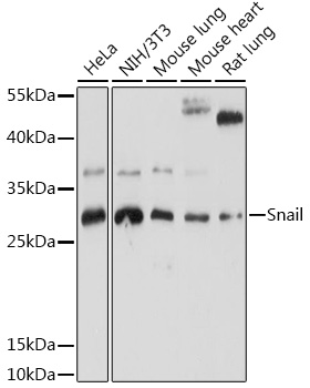 Snail Polyclonal Antibody