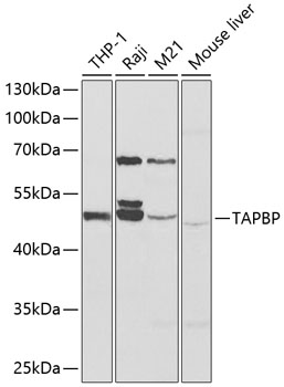 TAPBP Polyclonal Antibody