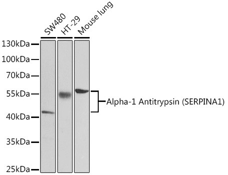 SERPINA1 Polyclonal Antibody