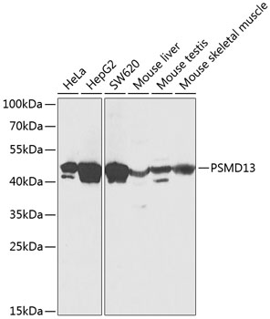 PSMD13 Polyclonal Antibody