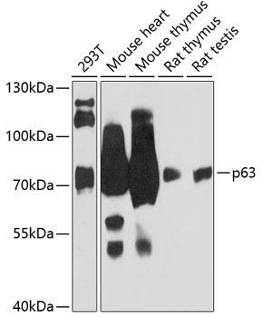 p63 Polyclonal Antibody