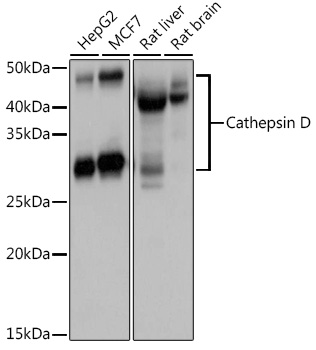 CTSD Polyclonal Antibody