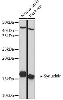 SNCA Polyclonal Antibody