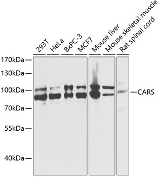 CARS Polyclonal Antibody