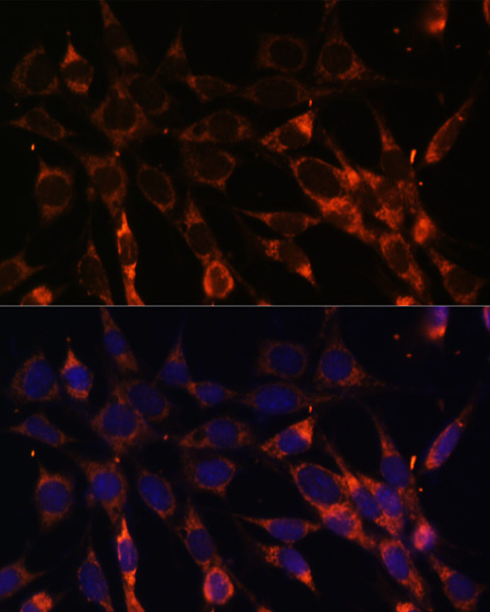 SMAD6 Polyclonal Antibody