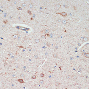 AFG3L2 Polyclonal Antibody