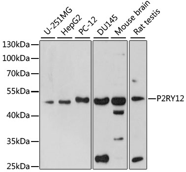 P2RY12 Rabbit Polyclonal Antibodies