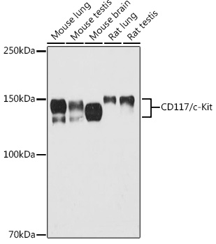 KIT Rabbit Polyclonal Antibody