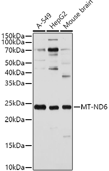MT-ND6 Rabbit Polyclonal Antibody
