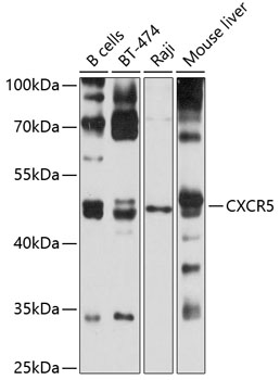 CXCR5 Rabbit Polyclonal Antibody