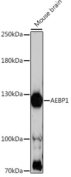 AEBP1 Rabbit Polyclonal Antibody