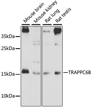 TRAPPC6B Polyclonal Antibody