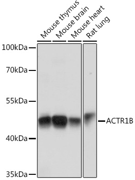 ACTR1B Polyclonal Antibody