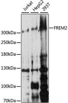 FREM2 Polyclonal Antibody