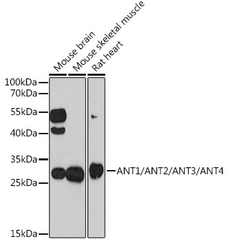 ANT1/ANT2/ANT3/ANT4 Polyclonal Antibody