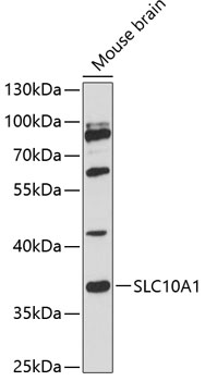 SLC10A1 Rabbit Polyclonal Antibody