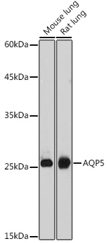 AQP5 Rabbit Polyclonal Antibody