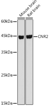 CNR2 Rabbit Polyclonal Antibody