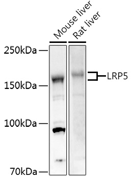 LRP5 Rabbit Polyclonal Antibody