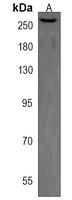 ROS1 Rabbit Polyclonal Antibody