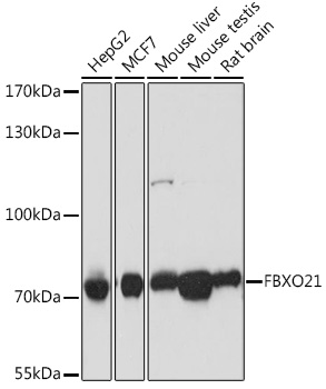 FBXO21 Polyclonal Antibody