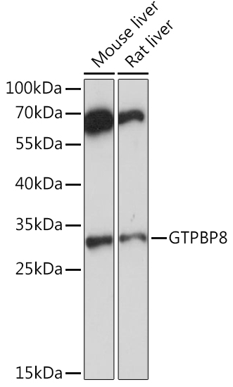 GTPBP8 Polyclonal Antibody
