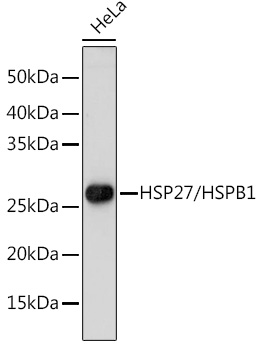 [KO Validated] HSPB1 Polyclonal Antibody