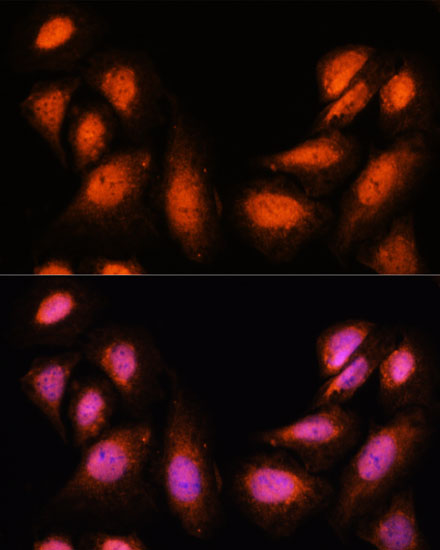 SUPT6H Polyclonal Antibody