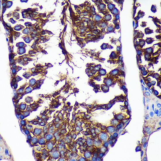 CTNNA3 Polyclonal Antibody